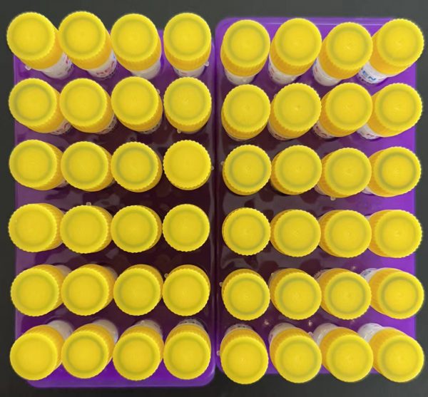 Recombinant human squamous cell carcinoma antigen (SCC)