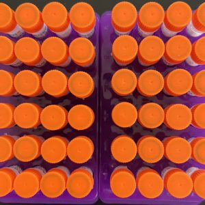 Recombinant human heart type fatty acid binding protein (H-FABP)